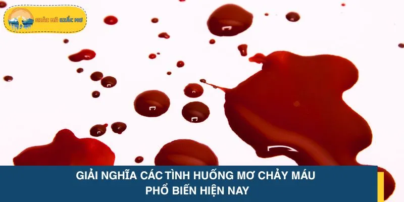 Giải nghĩa các tình huống mơ chảy máu phổ biến hiện nay