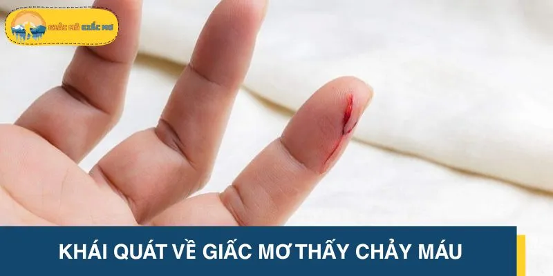 Khái quát về giấc mơ thấy chảy máu